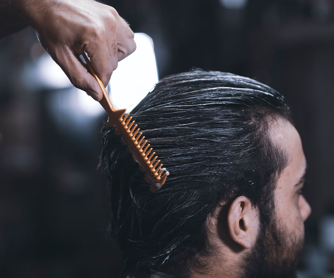 FUE Hair Transplant Side Effects and How to Treat Them - Northwestern Hair Chicago - Dr. Vinay FUE Hair Transplant Side Effects and How to Treat Them - Northwestern Hair Chicago - Dr. Vinay
