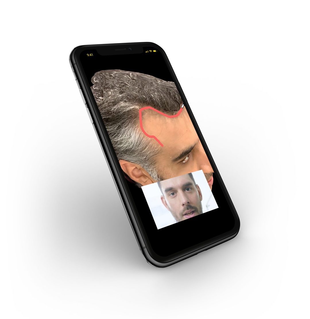 best hair restorer doctor vany rawlani chicago IL best hair restorer doctor vany rawlani chicago IL