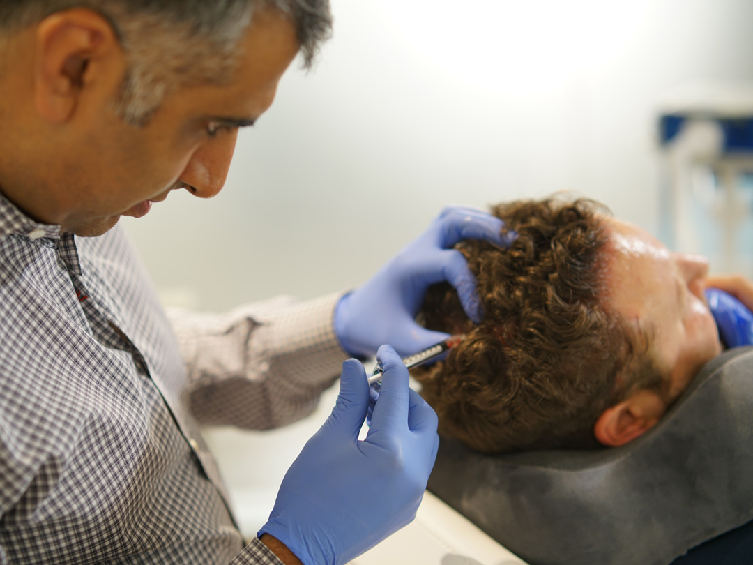 top hair transplant doctor Vinay Rawlani, MD performs hair loss treatment in Chicago