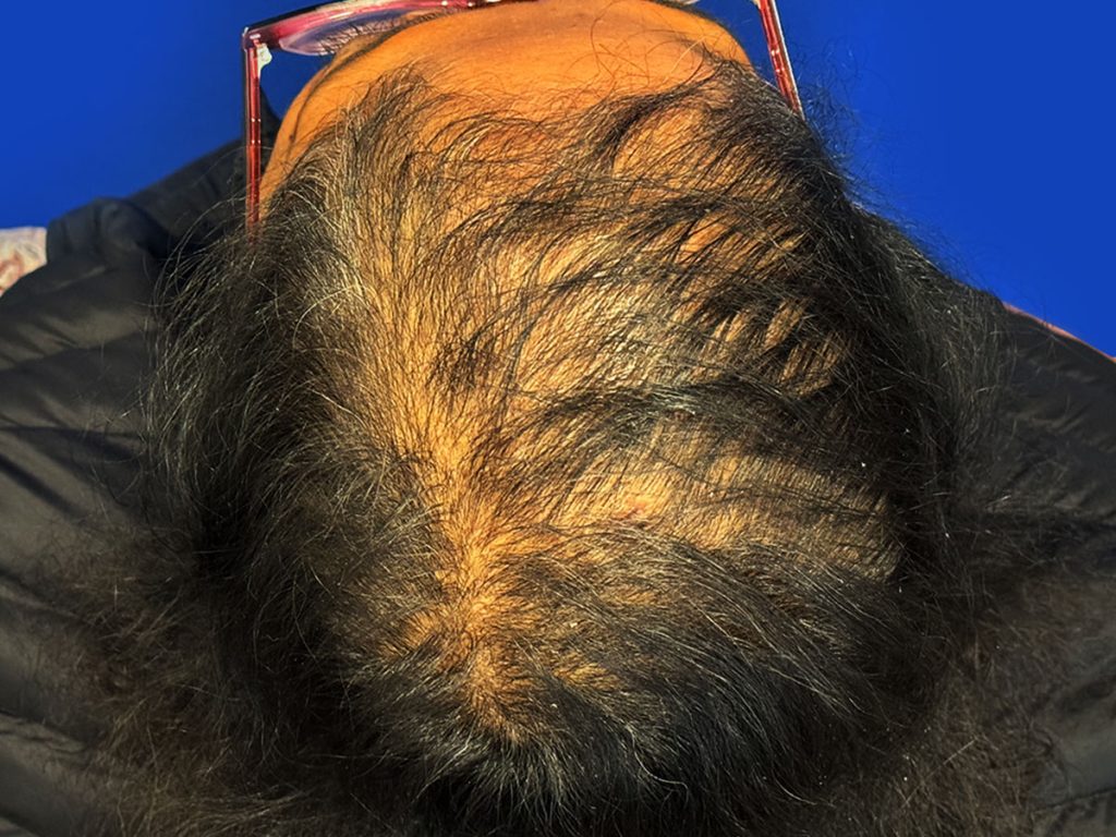 RANI Mar 15 2024 1