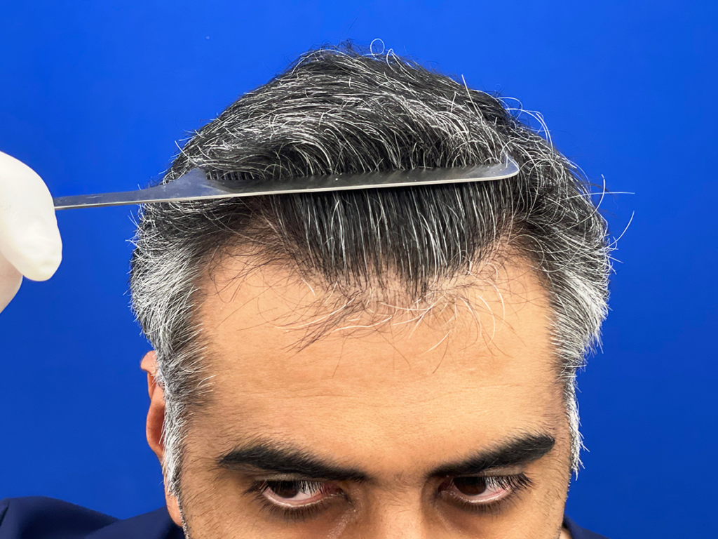 vinay after 01