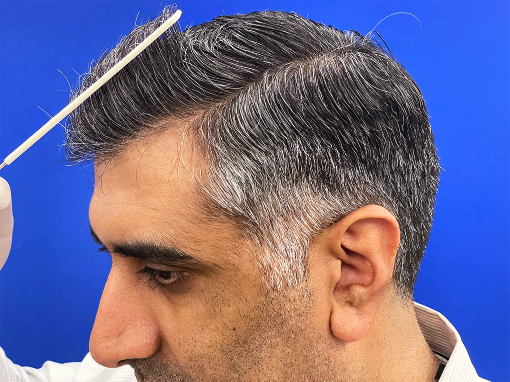 vinay after 03