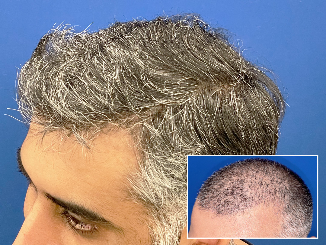 Vinay-9-month-result