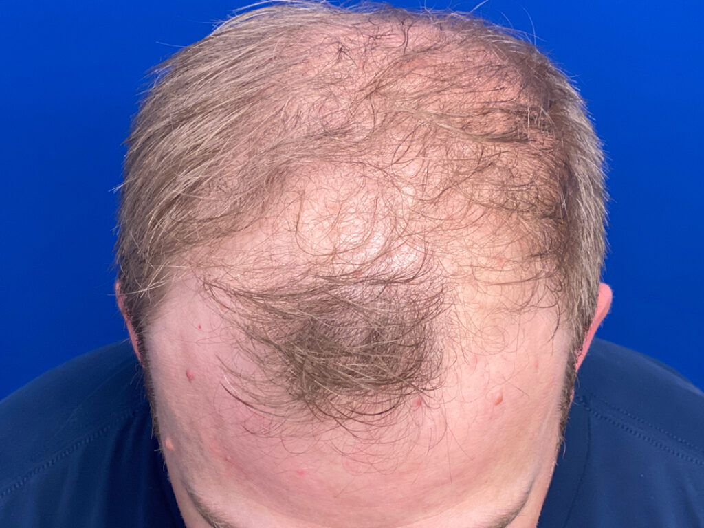 before-top