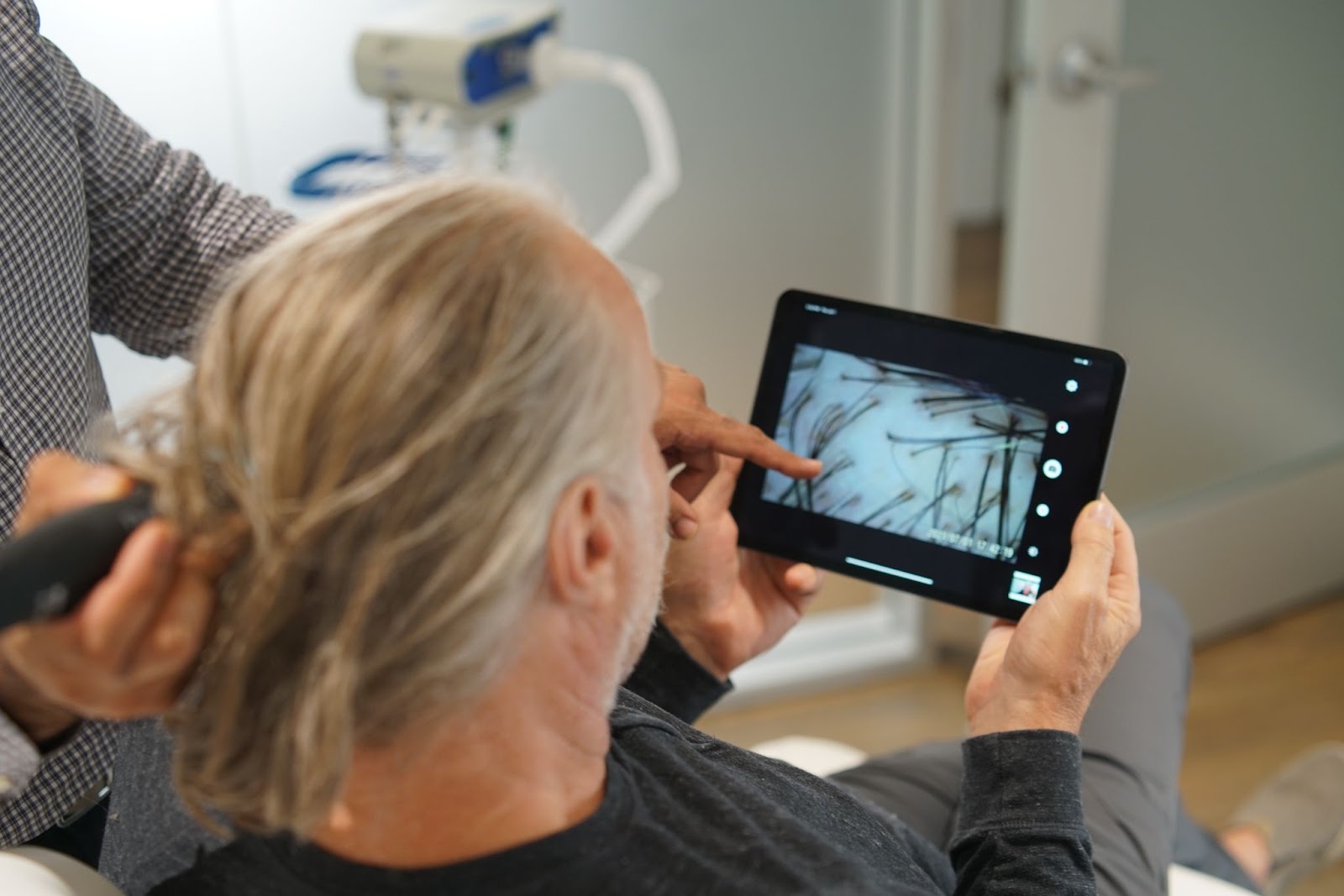 causes-of-male-pattern-baldness