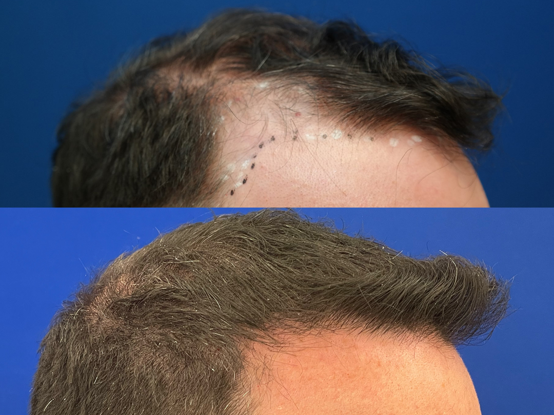 jeff-right-oblique-view