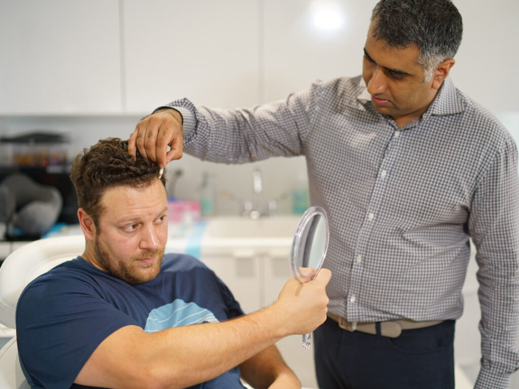 vinay-marking-chriss-hairline