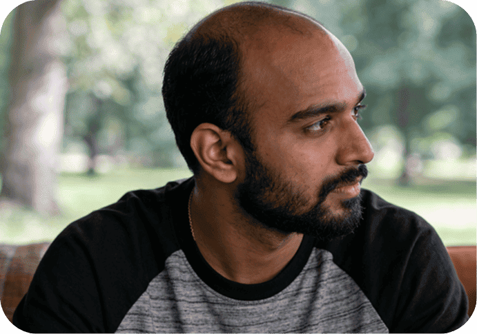 hair transplant candidate