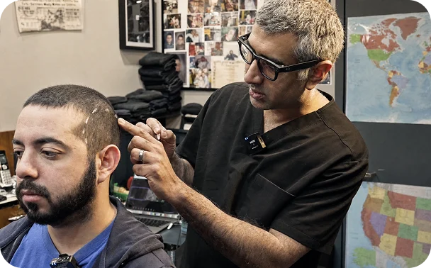 Crown Hair Recession