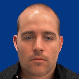 Elliot, 30, man, FUE hair transplant Chicago, hairline, 2,808 grafts, before and after photos