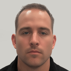 Elliot, 30, man, FUE hair transplant Chicago, hairline, 2,808 grafts, before and after photos