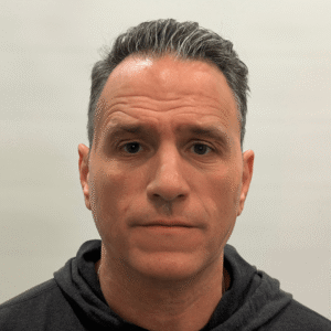 Franco, 53, man, Micro PUE® hair transplant Chicago, hairline, 3,010 grafts, before and after photos