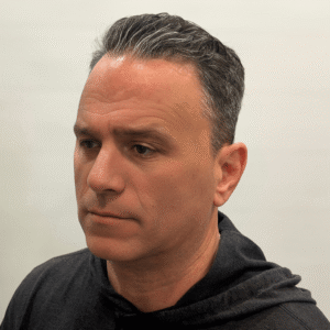 Franco, 53, man, Micro PUE® hair transplant Chicago, hairline, 3,010 grafts, before and after photos