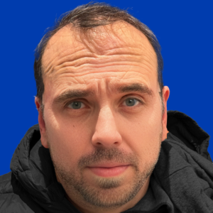 Ronan, 51, man, FUE hair transplant Chicago, hairline, 3,649 grafts, before and after results