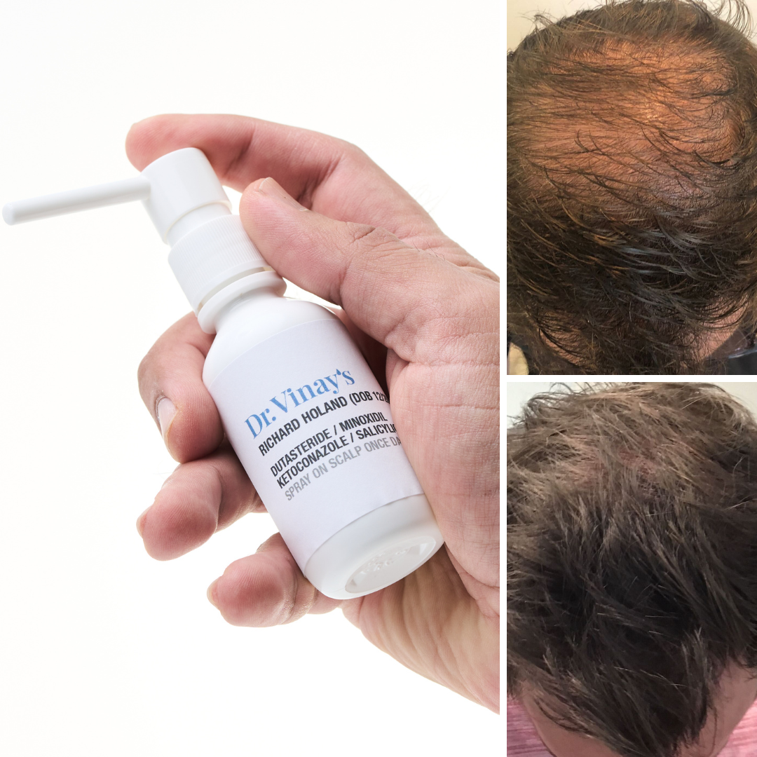 Topical Solution