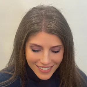 Brandy, 40, woman, non-surgical hair restoration Chicago, before and after pictures