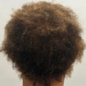 Cynthia, African American woman, non-surgical hair restoration Chicago, before and after results