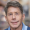 Tom, male pattern baldness. CNC hair replacement system by NorthwesternHair, Laws Clinic, Chicago