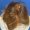 Bree, 80, woman, non-surgical hair restoration Chicago, before and after results