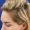 Clara, woman, medical hair loss treatment Chicago, before and after results