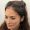 Mae, 25, Hispanic woman, Micro PUE® hair transplant Chicago, 2,200 grafts, before and after pictures