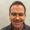 matt 43 years old hair transplant micro pue norwood 6-7 hairline crown 13216 grafts before and after result