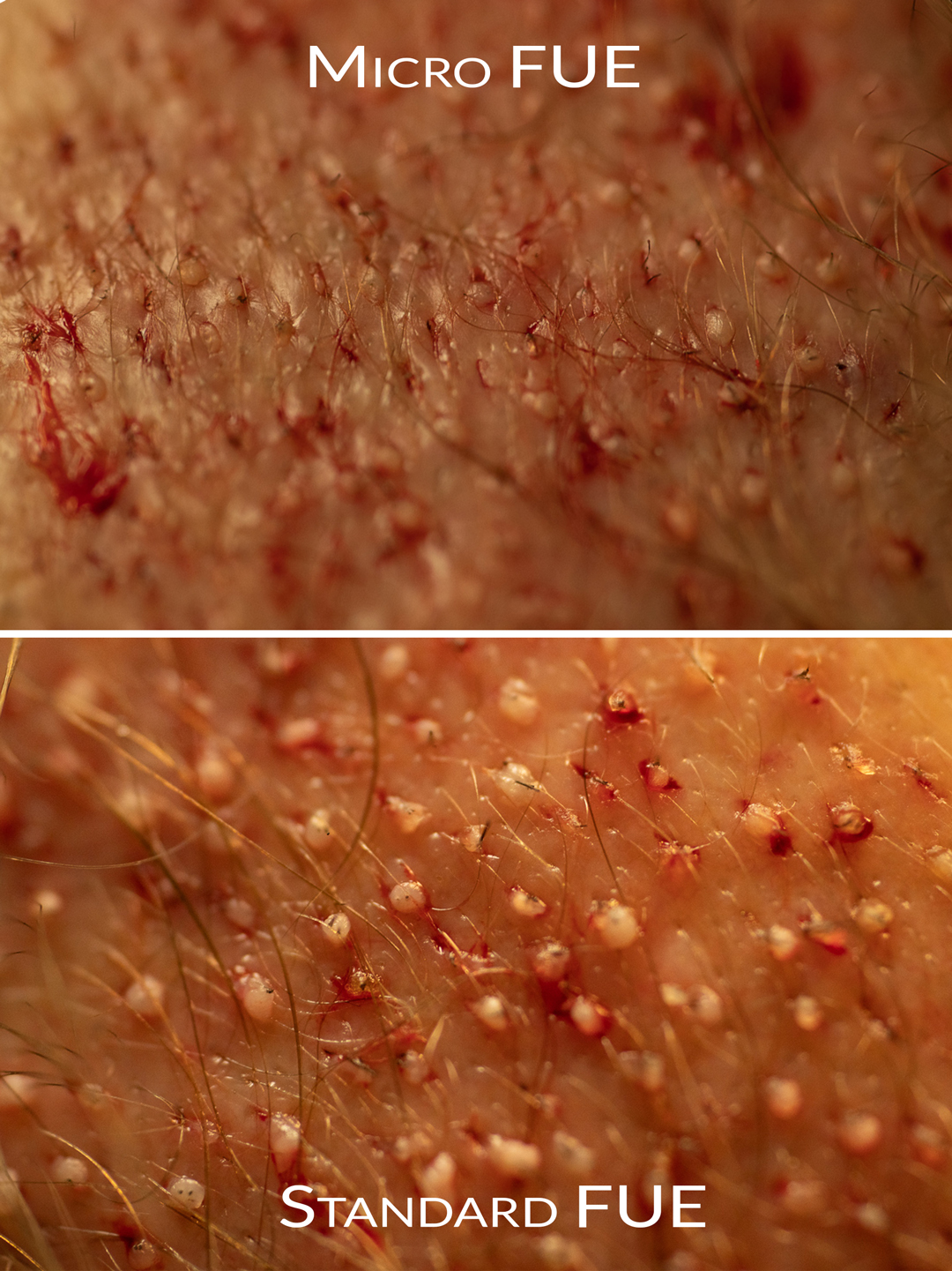close-up-graft-comparason