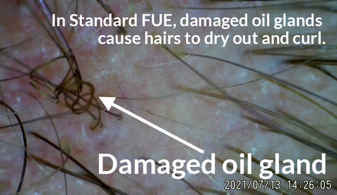 damaged oil gland 2 1