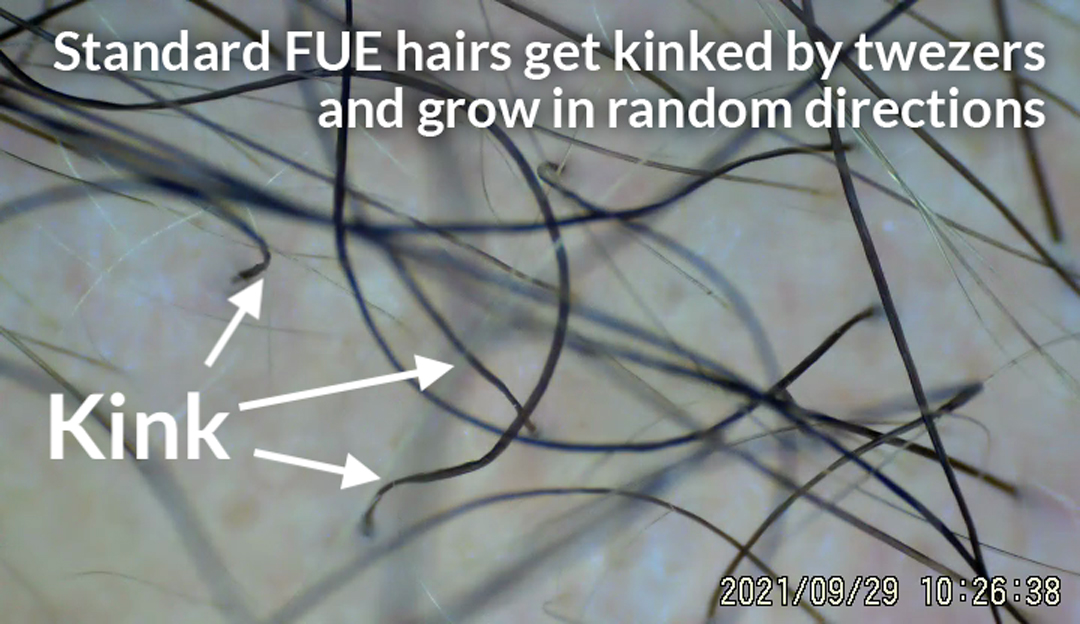 kinked-hairs