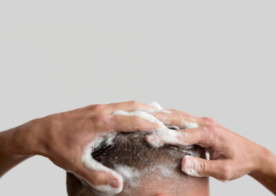 How fast does a Discrete FUE heal?